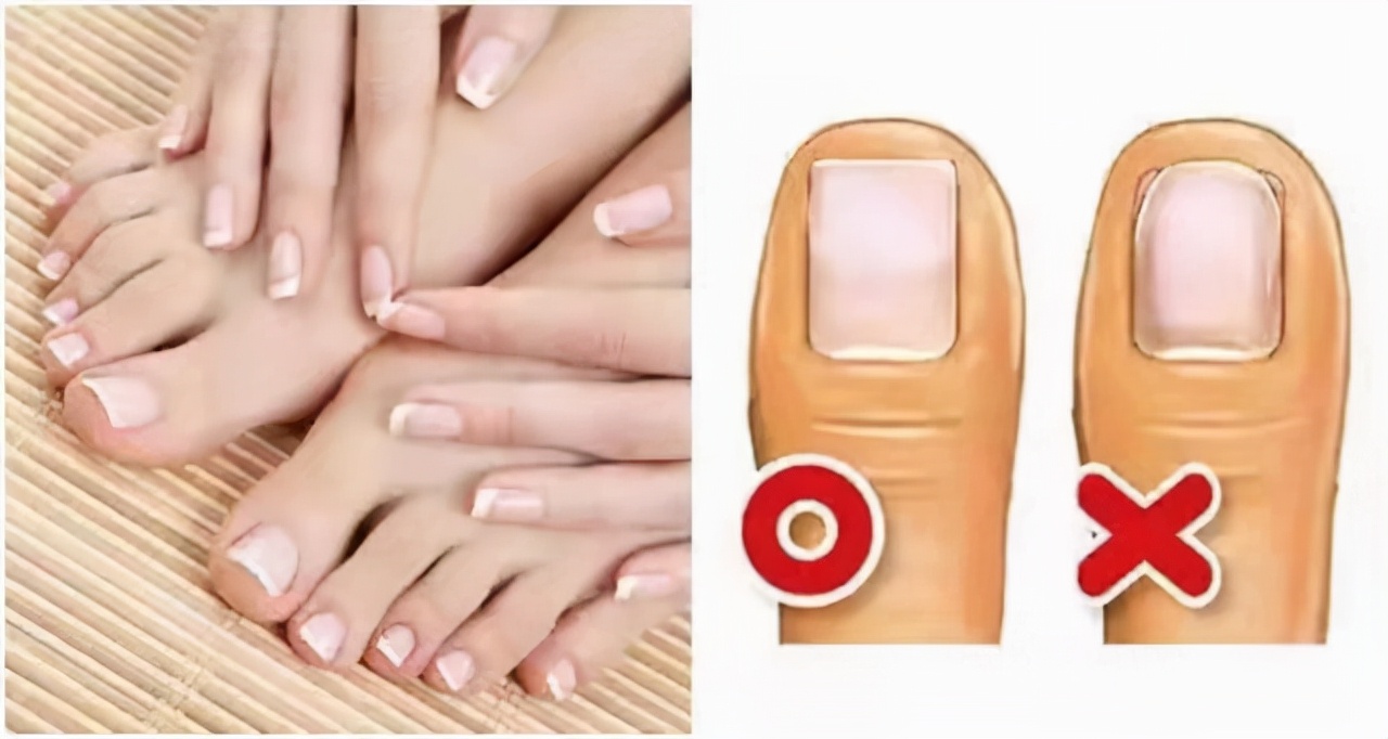 大脚趾甲很厚往肉里长怎么治疗,大脚趾甲受伤后变厚变脆怎么恢复