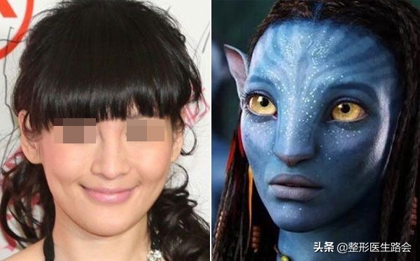 黄晓明颧骨高吗,颧骨高一仰头都凸出来了