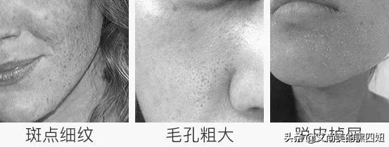 面霜怎样使用才是最好的,如何正确使用保湿面霜