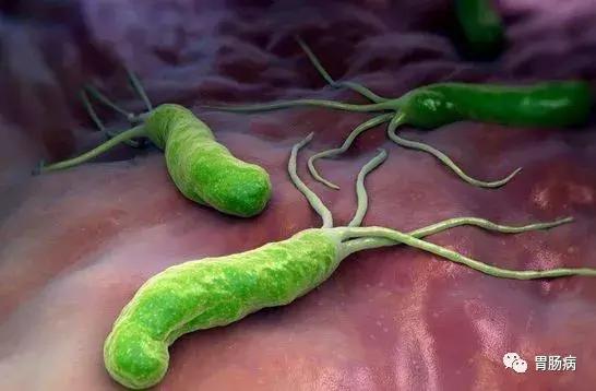 关于胃炎的30个问题，你想知道的全在这里！