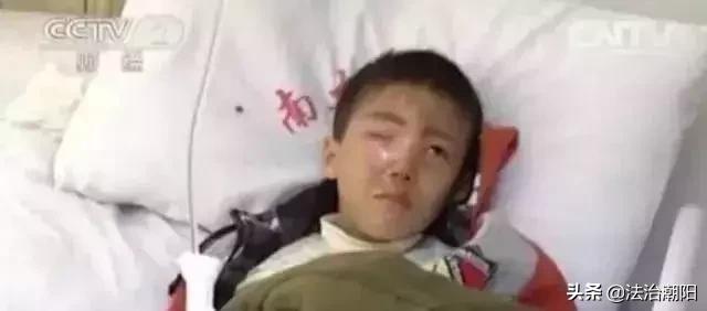 荧光棒弹伤眼睛男孩脱落显失明,男孩眼球被溶化的原因