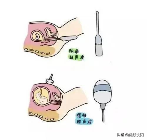 健康科普疼痛视频,肚子疼做腹部超声波能看出来吗