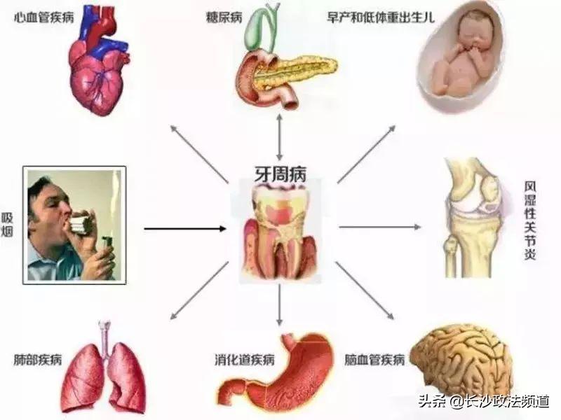湖南人有消费券吗,湖南省2021看牙补贴政策是真的吗