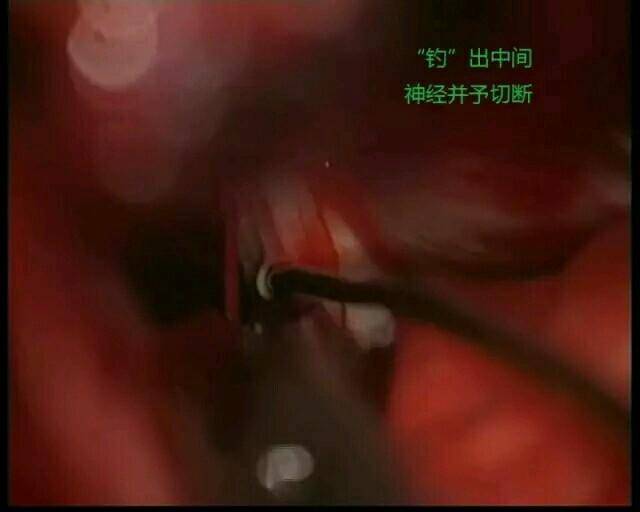 男子意外遭电击变植物人,深圳男子深夜被电击