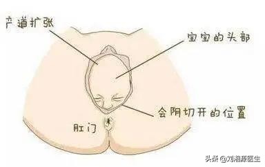 「免疫相关不良妊娠答疑解惑62」——分娩