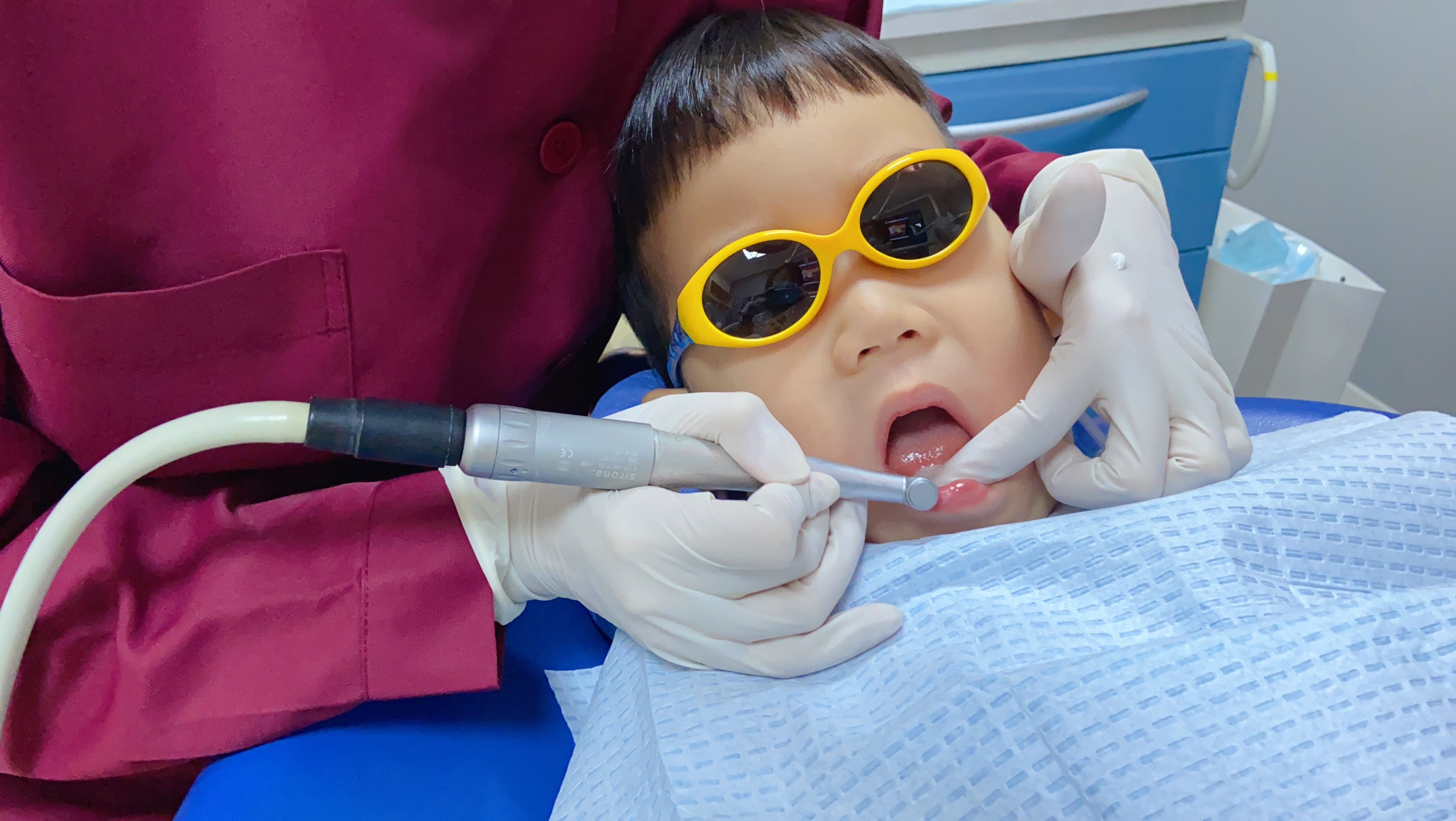 用含氟牙膏刷牙可能会引起虫牙吗,天天刷含氟牙膏还有必要涂氟吗