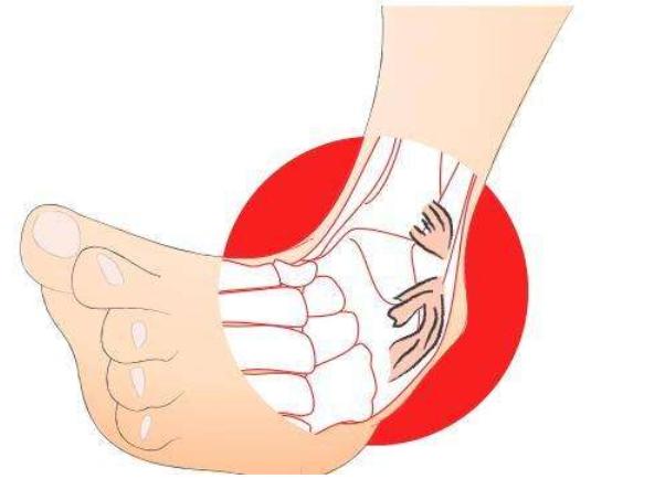 预防运动损伤常见的方法,运动损伤预防及处理的视频20分钟