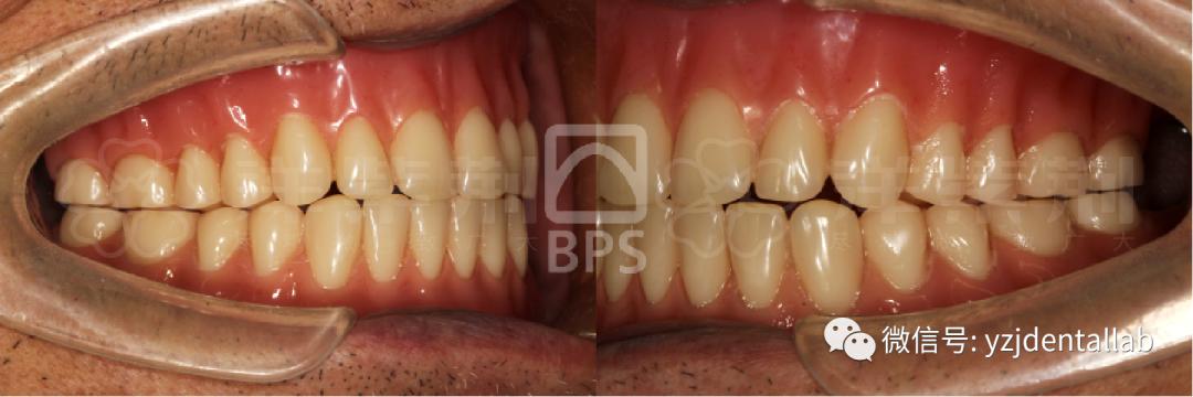 病例教学视频,病例分析操作技能