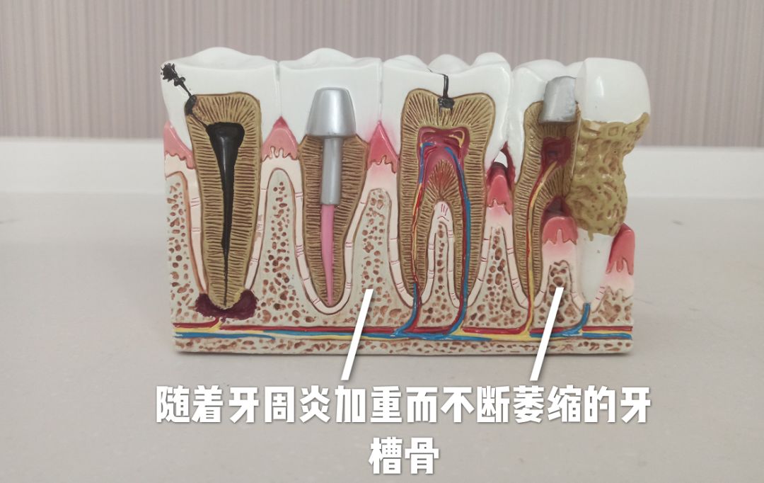 helen榻跨,Helen榻跨涓績