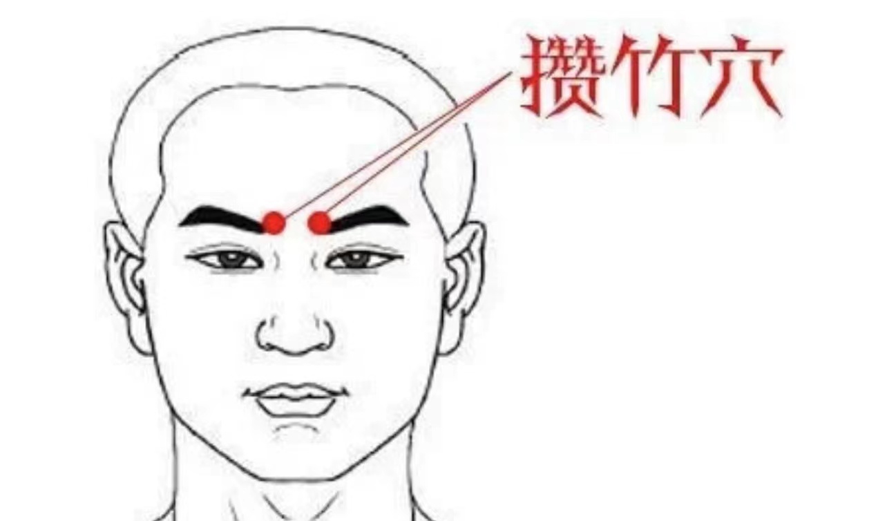 解决肿瘤患者顽固性呃逆优秀案例分享