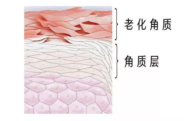 冬天面部角质层薄起皮泛红,换季敏感皮肤泛红脱皮怎么办