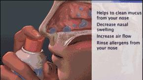 过敏性鼻炎现在喉咙疼吃药不管用,过敏性鼻炎吃药一停就犯了怎么办