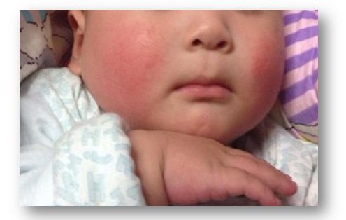 宝宝皴脸了抹什么面霜,婴儿防皴面霜0-3岁秋冬补水保湿