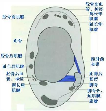 踝关节撞击症问诊,踝关节内侧撞击综合症位置图