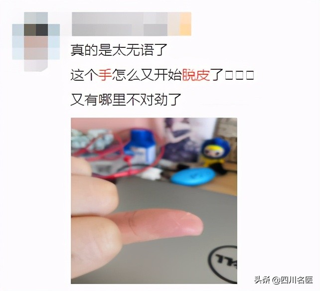 你的手为什么老脱皮,你的手为什么这么糙