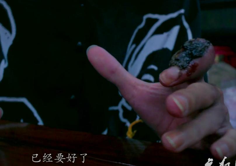 腾讯最新纪录片，记录人与毒宠的相爱相杀，堪称开年第一！