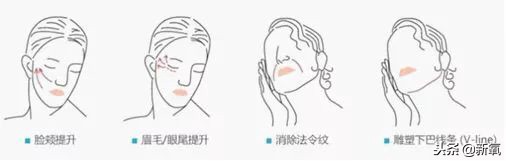 辛芷蕾是苦相女生吗,辛芷蕾气质怎么养成