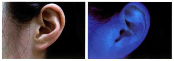 怀疑猫咪身上有虫怎么检查,怀疑猫咪有猫癣怎么办