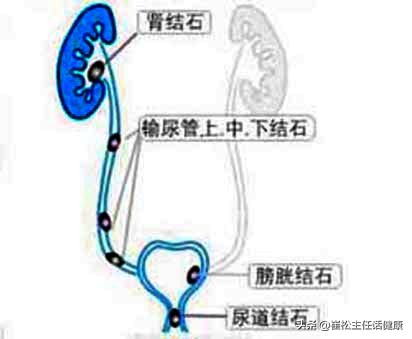 疫情有腹痛症状吗,有没有疫情期间肚子疼