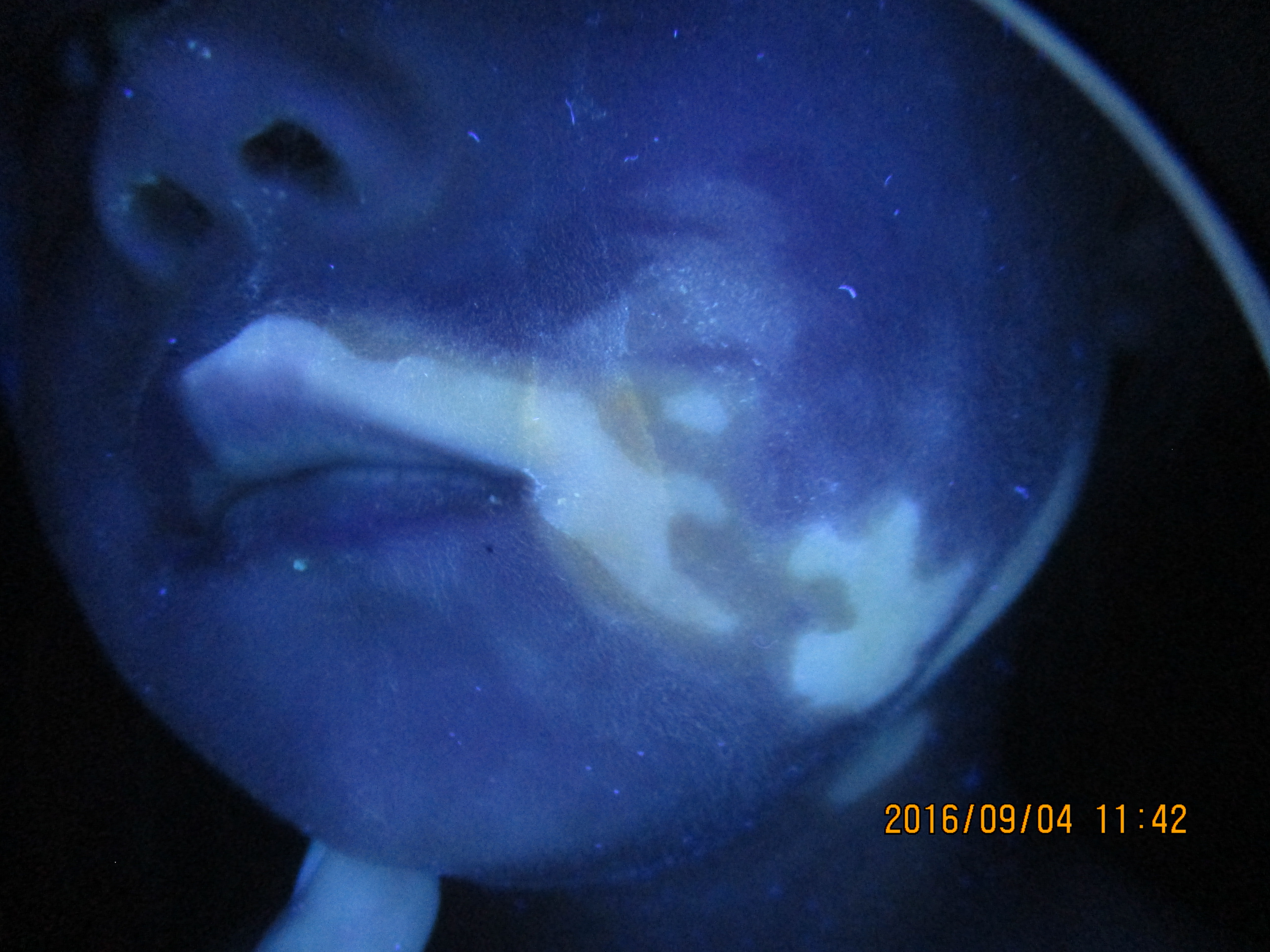 小孩缺锌脸上长的白斑叫什么,小孩脸上长白斑怎么办啊