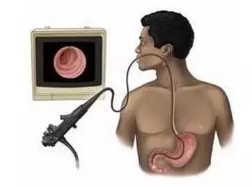 x光b超ct核磁共振区别,ctx光和b超核磁共振的区别