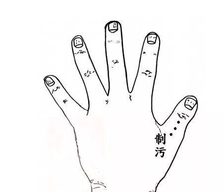 44岁月经一直提前几天突然推迟,月经不是提前就是推后