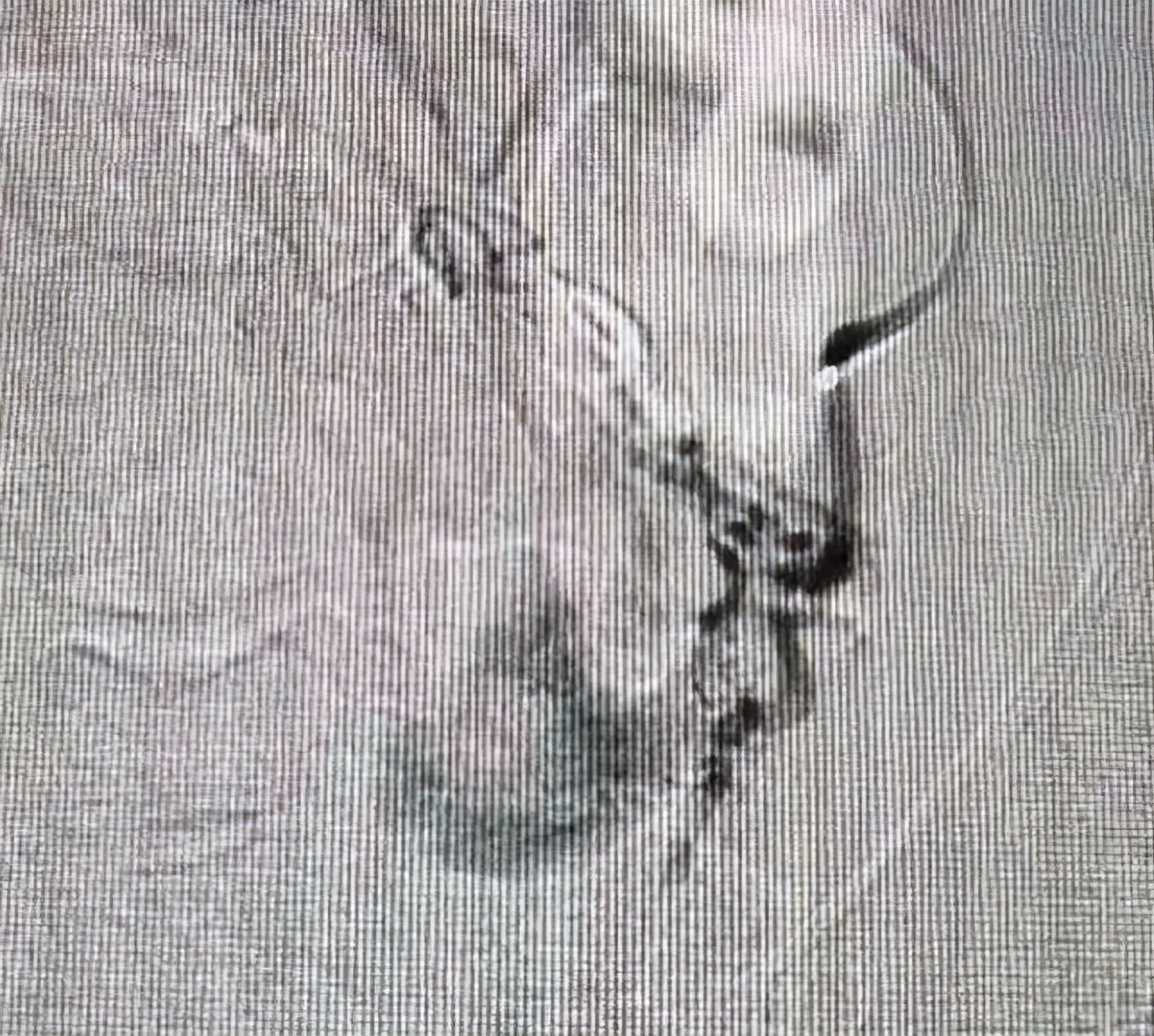 膀胱肿瘤患者吃什么保健品,膀胱肿瘤特效药