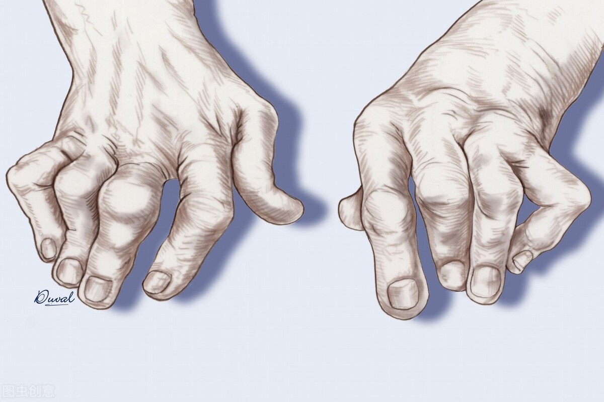 痛风用中药调理能使代谢恢复吗,痛风消肿止痛中药调理方法