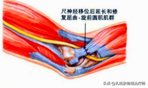 手指麻木是三大疾病前兆,手指麻木疼痛怎么治疗最好