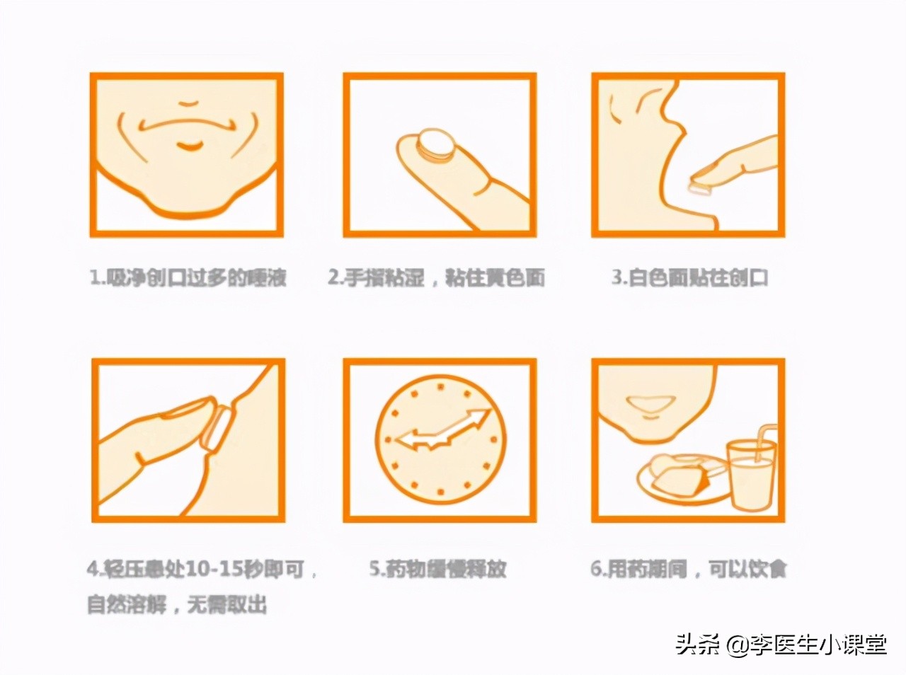 口腔溃疡很痛吃东西喊痛,口腔溃疡吃维生素b2还是维生素c好