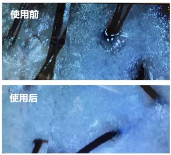 油头救星澳洲茶树洗发水,茶树精油酸性顺滑洗发水