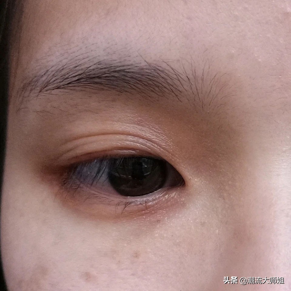 皮肤干燥又长斑先补水还是祛斑,长斑容易导致皮肤松弛