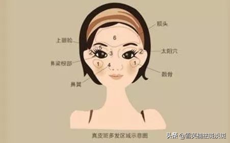 目前最有效最好的祛斑方法,目前最有效果的祛斑方法