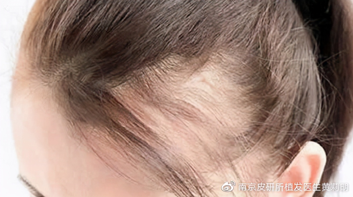 怎么让头发变得又黑又亮有光泽,如何保养头发让头发又黑又浓