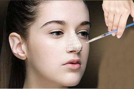 为什么不建议打眉弓针呢,为什么不建议假体隆鼻
