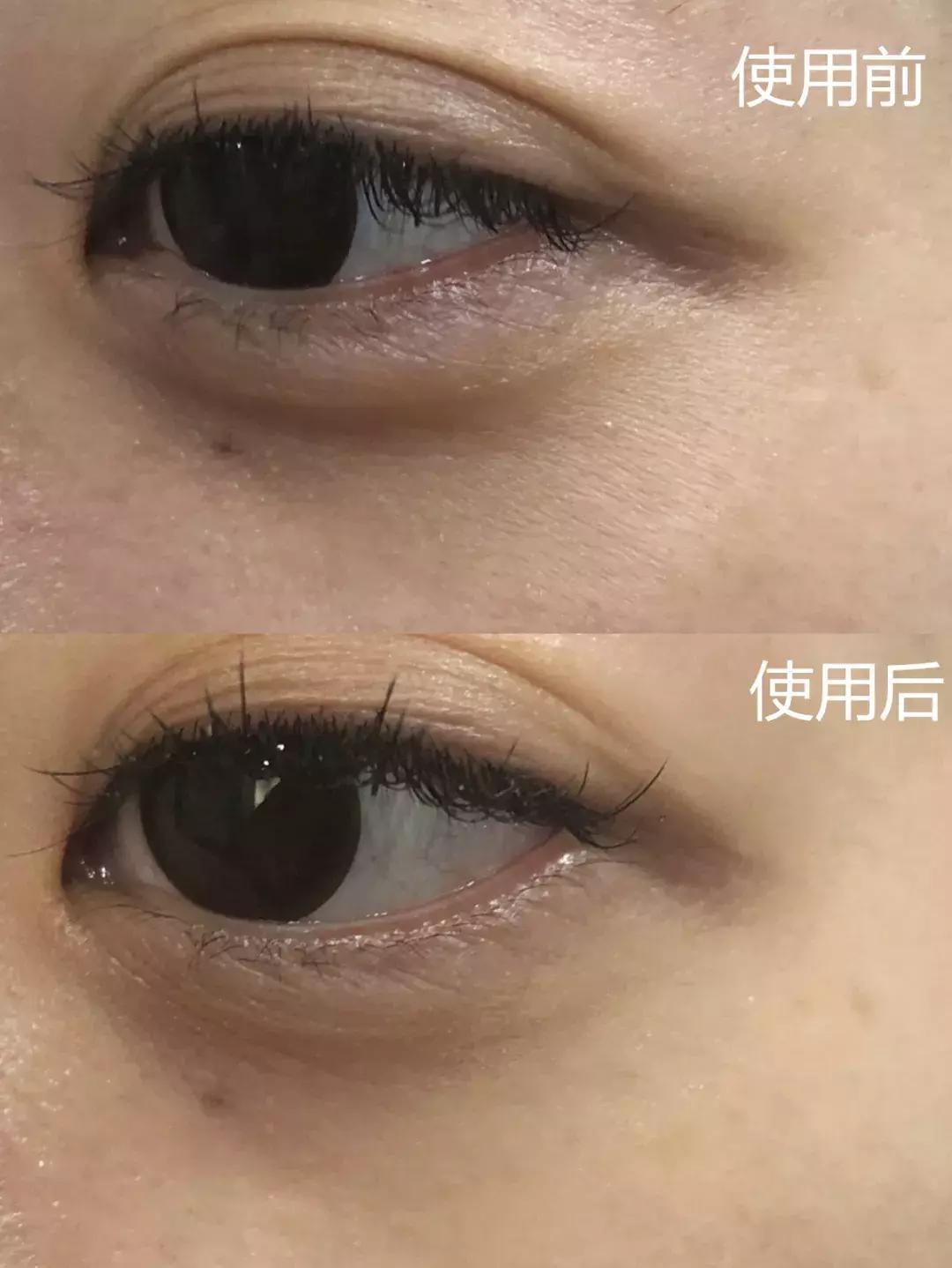 补水保湿淡化黑眼圈眼袋,黑眼袋黑眼圈用什么护肤品消除