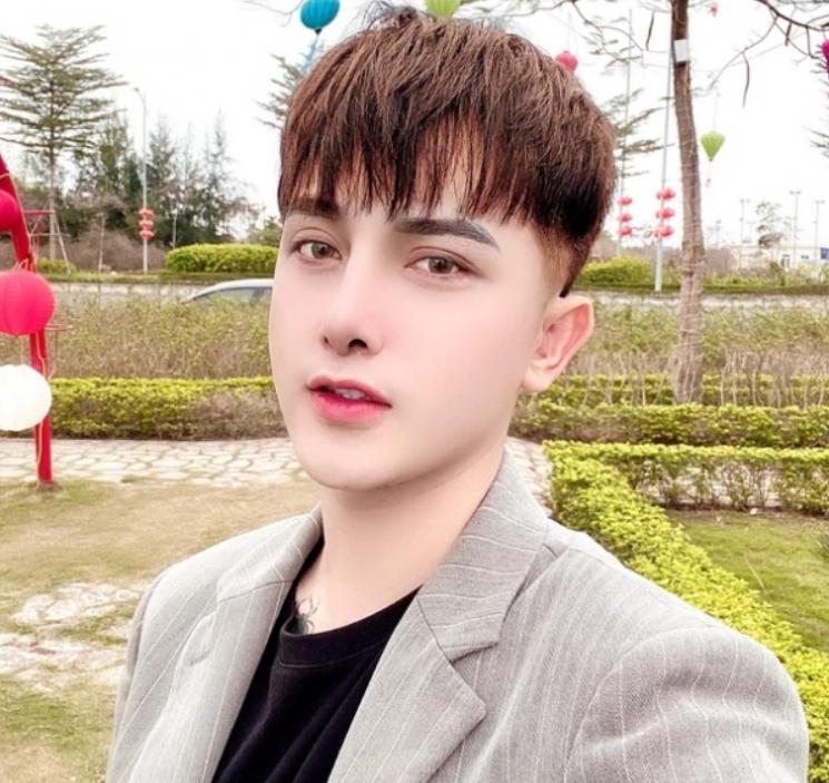 越南丑男整容变帅,越南小伙儿整容成功