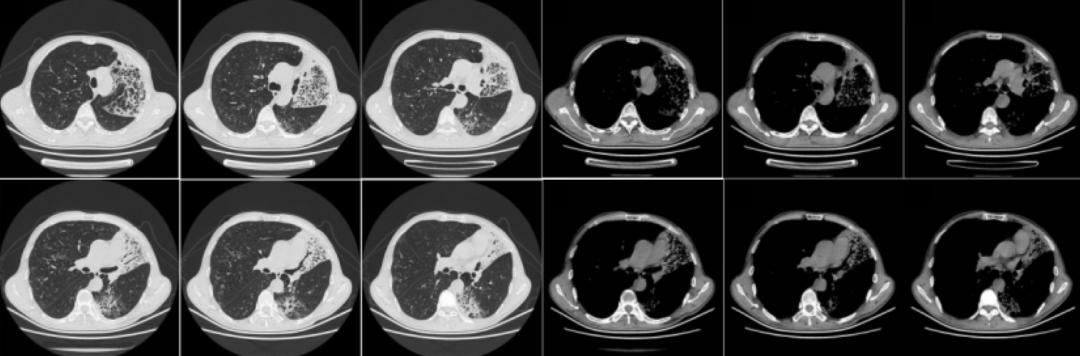 时隔一年再次住院,时隔一年旧病复发