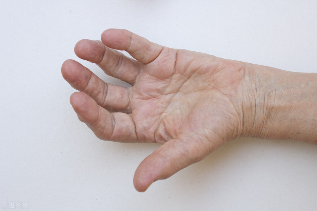 类风湿夏天应注意什么,怎样才能预防类风湿