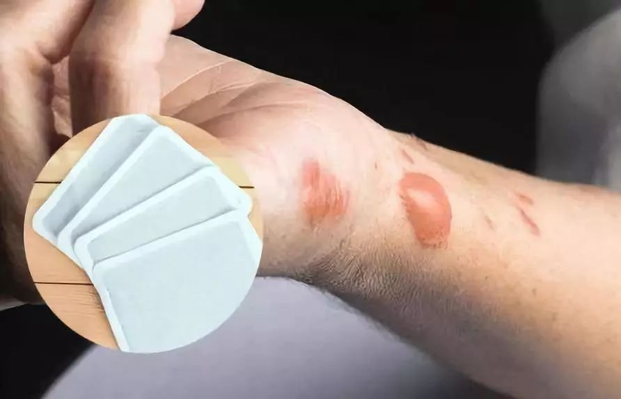 如何摆脱老寒腿,告别老寒腿护膝