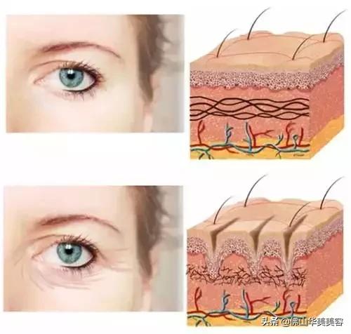 佛山禅城华美整形美容,佛山华美医疗美容高明