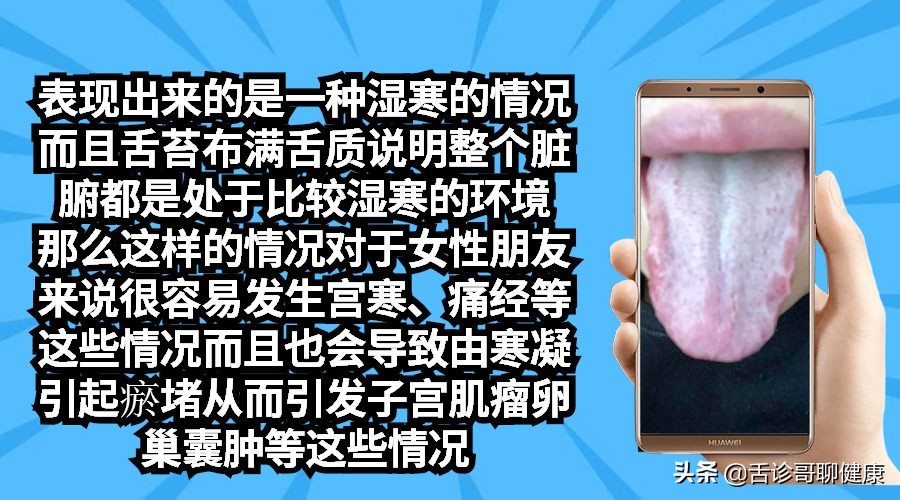 舌诊哥聊血瘀,舌诊哥聊健康肝胆