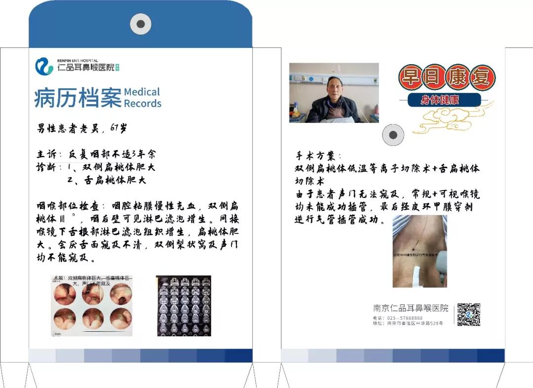 手术历经两小时患者术中咽喉创面几乎无出血