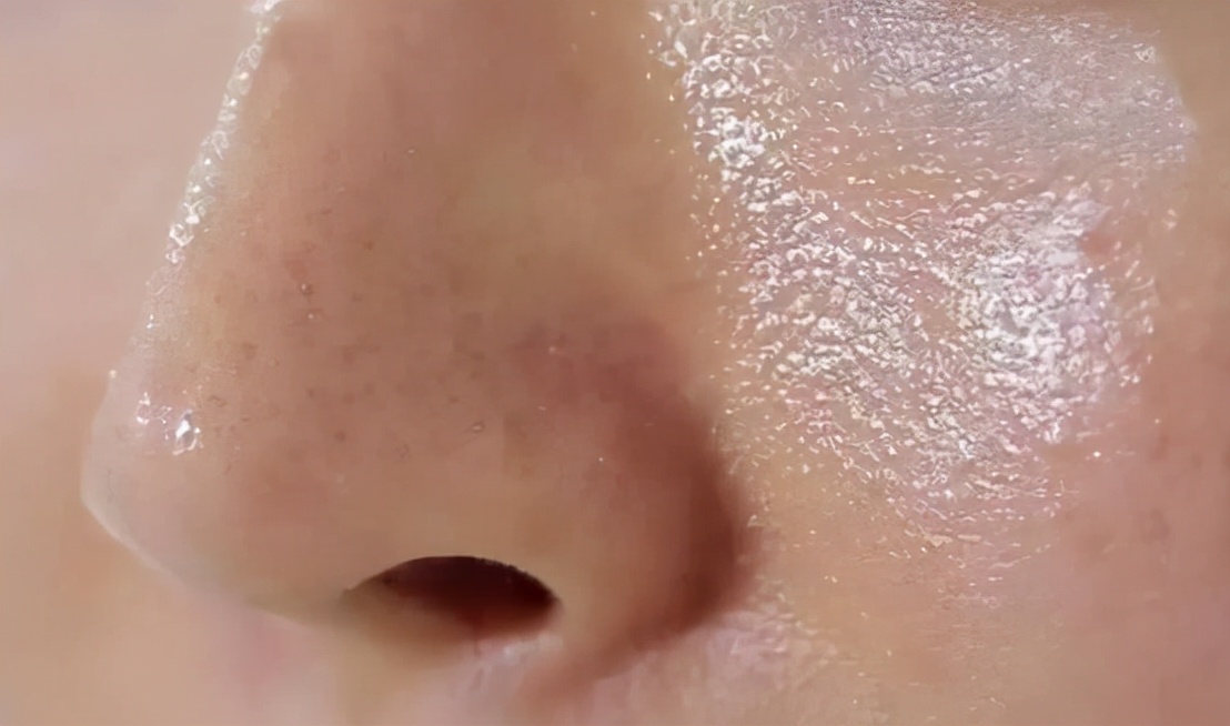 头发出现疙瘩,头发长出红疙瘩怎么回事