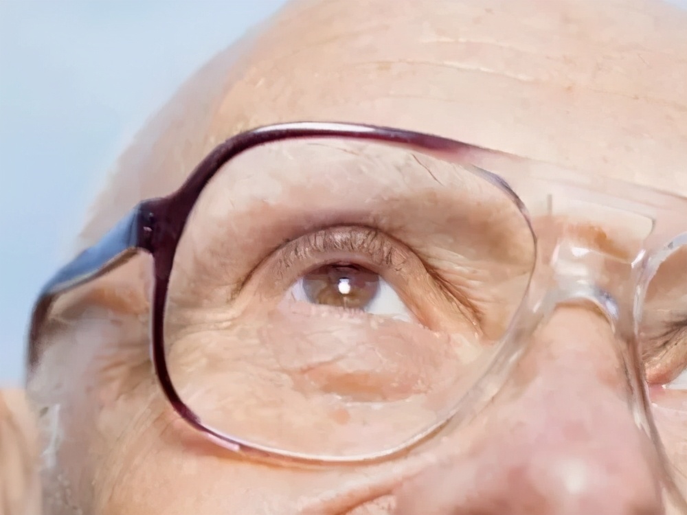 老年人白内障的预防和治疗,老年白内障食疗