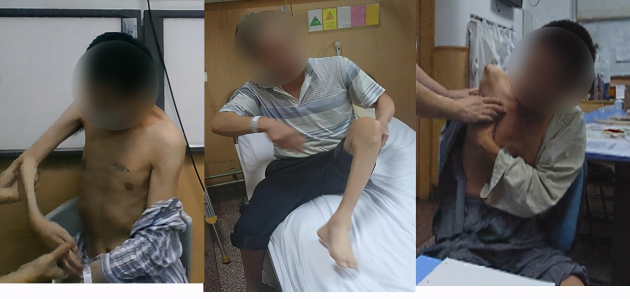 棰堥珦鍒囧紑,棰堥珦鎹熶激寰垱鎵嬫湳