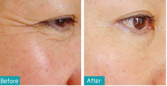 戚薇涂眼霜真的有效果吗,戚薇分享眼霜涂抹方法