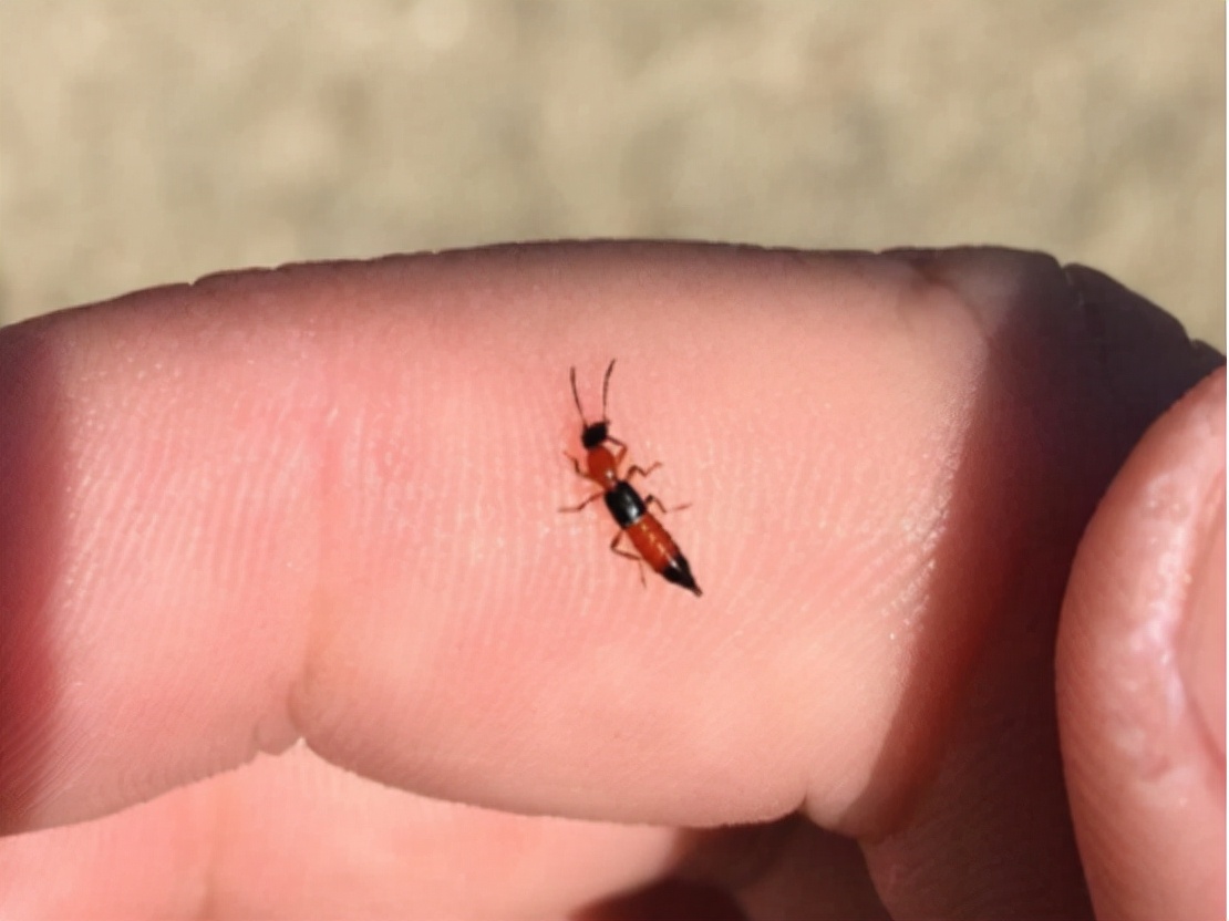 被隐翅虫毒液沾到涂什么药膏,被隐翅虫咬伤特效药