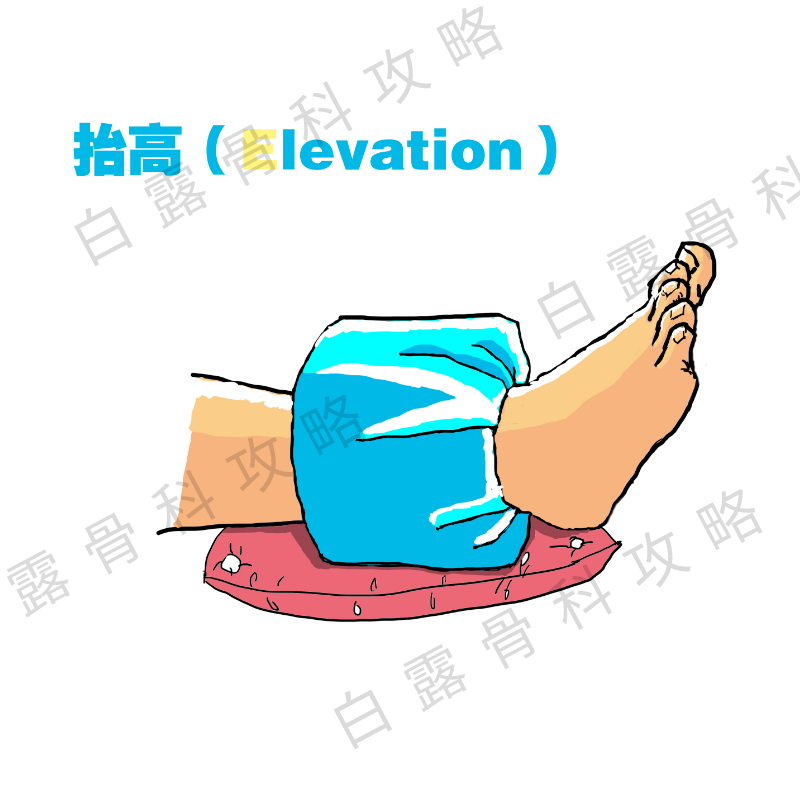 踝关节扭伤紧急处理,踝关节扭伤紧急处理视频