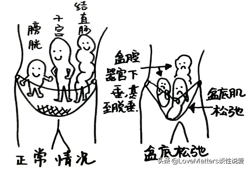 ella产后漏尿,ella产后恢复秘诀